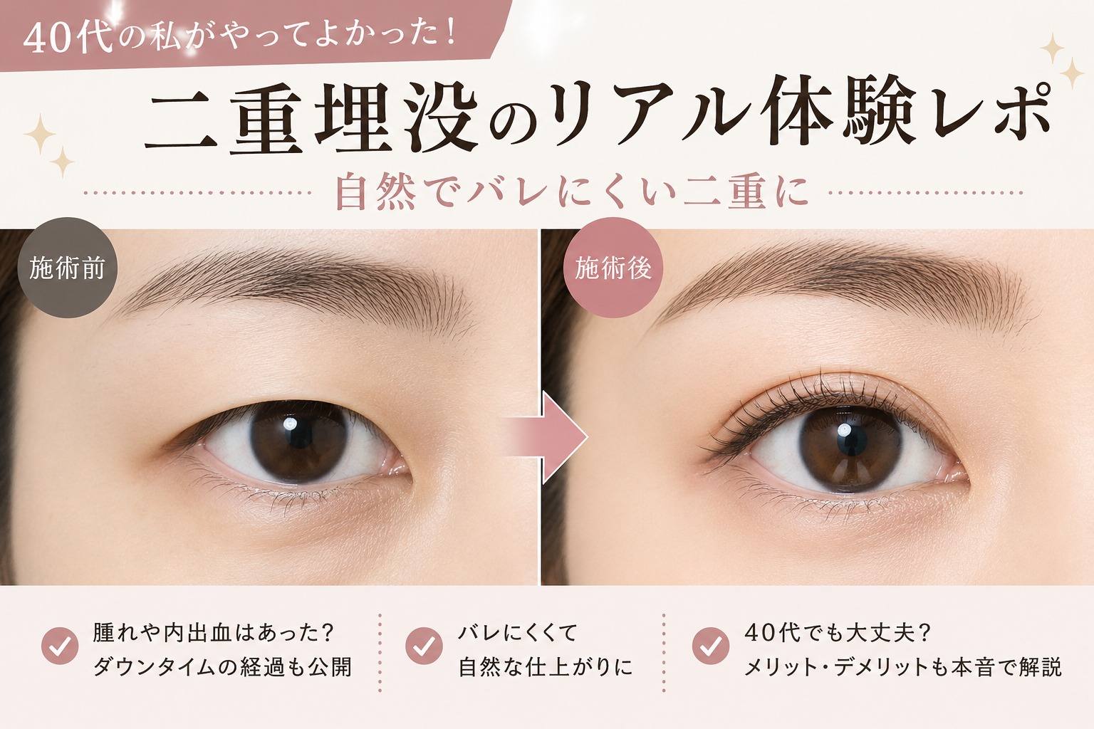 二重埋没のビフォーアフターの画像